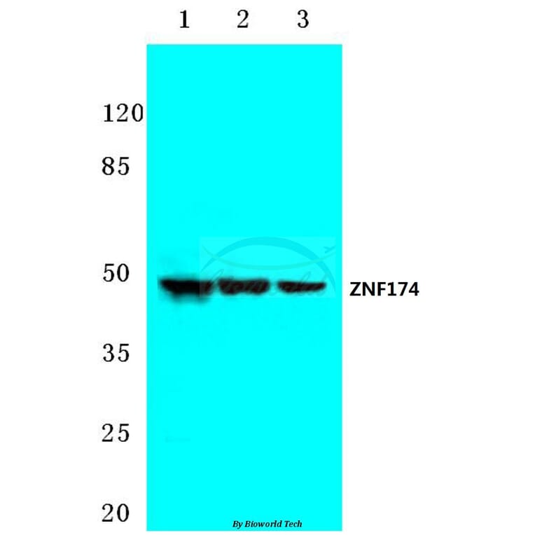 Anti-ZNF174 (E209) Antibody from Bioworld Technology (BS2073) - Antibodies.com