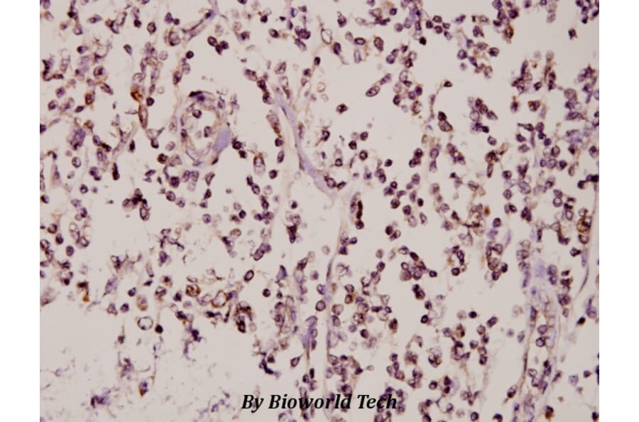 Anti-ZNF174 (E209) Antibody from Bioworld Technology (BS2073) - Antibodies.com