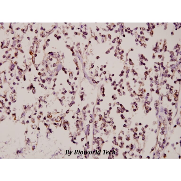 Anti-ZNF174 (E209) Antibody from Bioworld Technology (BS2073) - Antibodies.com