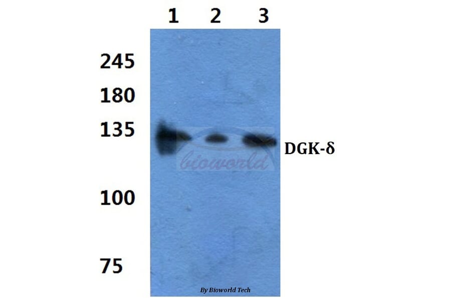 Anti-DGK-δ (S66) Antibody from Bioworld Technology (BS2078) - Antibodies.com