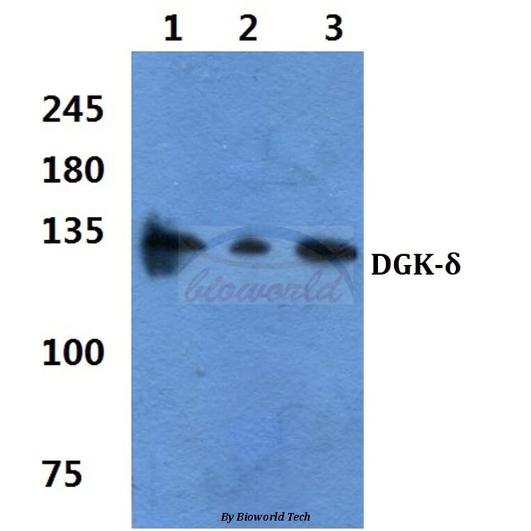 Anti-DGK-δ (S66) Antibody from Bioworld Technology (BS2078) - Antibodies.com