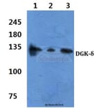 Anti-DGK-δ (S66) Antibody from Bioworld Technology (BS2078) - Antibodies.com
