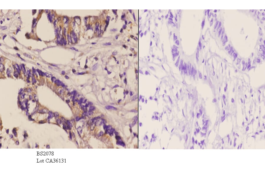 Anti-DGK-δ (S66) Antibody from Bioworld Technology (BS2078) - Antibodies.com