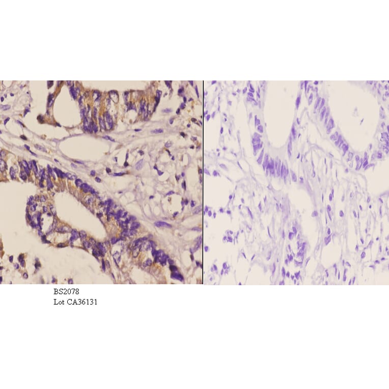 Anti-DGK-δ (S66) Antibody from Bioworld Technology (BS2078) - Antibodies.com