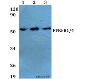 Anti-PFKFB1/4 (E349) Antibody from Bioworld Technology (BS2079) - Antibodies.com