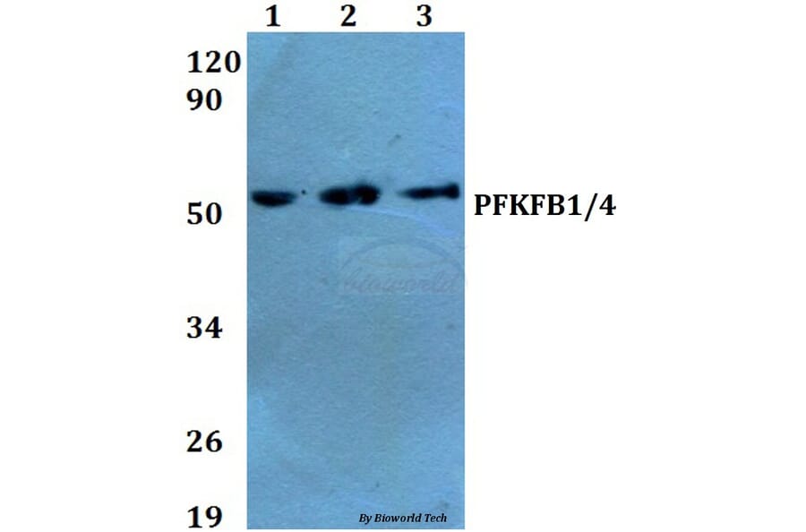 Anti-PFKFB1/4 (E349) Antibody from Bioworld Technology (BS2079) - Antibodies.com