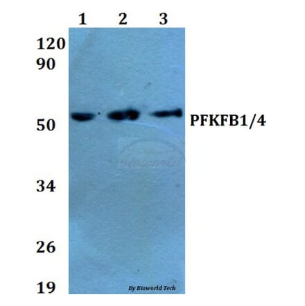 Anti-PFKFB1/4 (E349) Antibody from Bioworld Technology (BS2079) - Antibodies.com