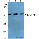 Anti-PFKFB1/4 (E349) Antibody from Bioworld Technology (BS2079) - Antibodies.com