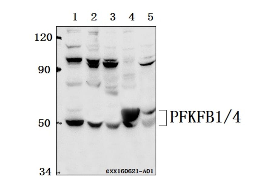 Anti-PFKFB1/4 (E349) Antibody from Bioworld Technology (BS2079) - Antibodies.com