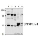 Anti-PFKFB1/4 (E349) Antibody from Bioworld Technology (BS2079) - Antibodies.com