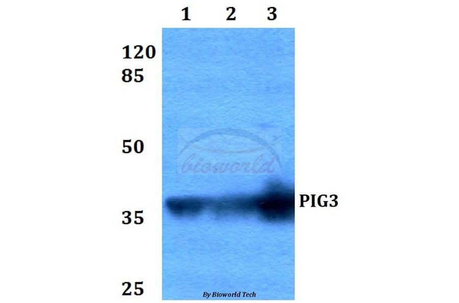 Anti-PIG3 (L265) Antibody from Bioworld Technology (BS2085) - Antibodies.com