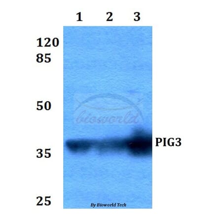 Anti-PIG3 (L265) Antibody from Bioworld Technology (BS2085) - Antibodies.com