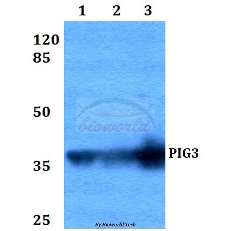 Anti-PIG3 (L265) Antibody from Bioworld Technology (BS2085) - Antibodies.com