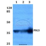 Anti-PIG3 (L265) Antibody from Bioworld Technology (BS2085) - Antibodies.com