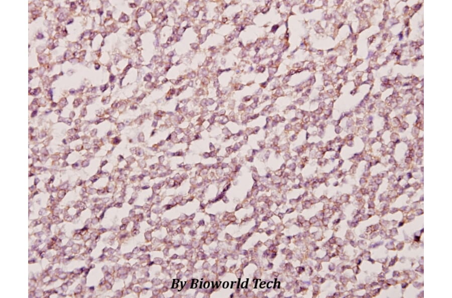 Anti-Emp (E207) Antibody from Bioworld Technology (BS2092) - Antibodies.com