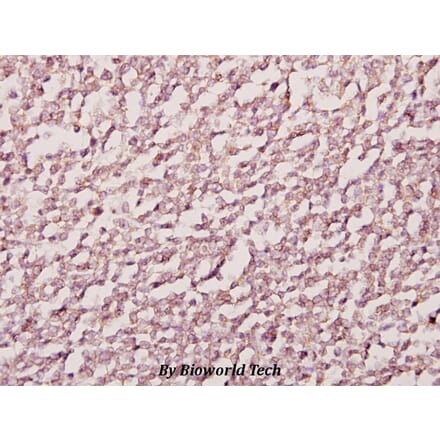 Anti-Emp (E207) Antibody from Bioworld Technology (BS2092) - Antibodies.com