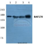 Anti-BAF170 (M388) Antibody from Bioworld Technology (BS2101) - Antibodies.com