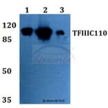 Anti-TFIIIC110 (R95) Antibody from Bioworld Technology (BS2107) - Antibodies.com