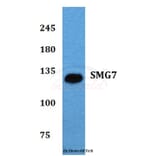 Anti-SMG7 (K548) Antibody from Bioworld Technology (BS2112) - Antibodies.com