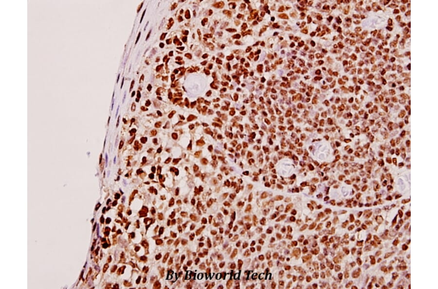 Anti-SMG7 (K548) Antibody from Bioworld Technology (BS2112) - Antibodies.com