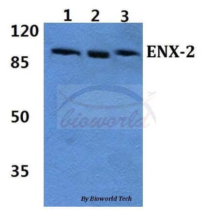 Anti-ENX-2 (E192) Antibody from Bioworld Technology (BS2114) - Antibodies.com