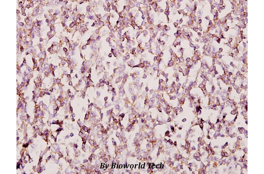 Anti-FoxB1/2 (I72) Antibody from Bioworld Technology (BS2130) - Antibodies.com