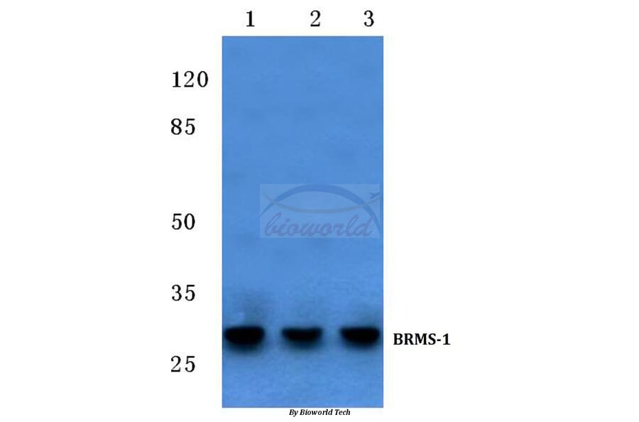Anti-BRMS-1 (E43) Antibody from Bioworld Technology (BS2144) - Antibodies.com