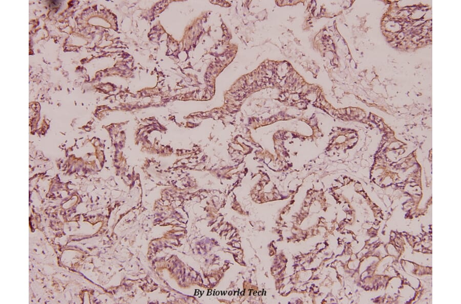 Anti-BRMS-1 (E43) Antibody from Bioworld Technology (BS2144) - Antibodies.com