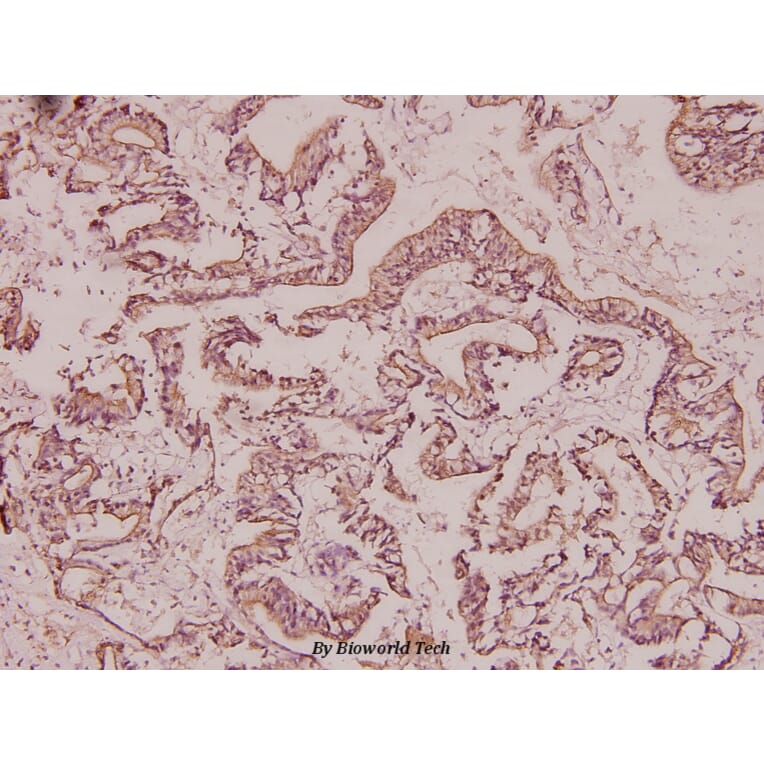Anti-BRMS-1 (E43) Antibody from Bioworld Technology (BS2144) - Antibodies.com