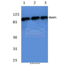 Anti-ERAP1 (K467) Antibody from Bioworld Technology (BS2155) - Antibodies.com
