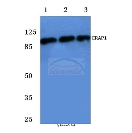 Anti-ERAP1 (K467) Antibody from Bioworld Technology (BS2155) - Antibodies.com