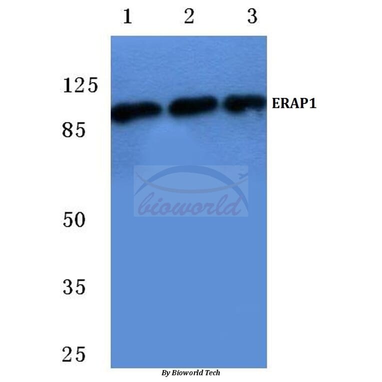 Anti-ERAP1 (K467) Antibody from Bioworld Technology (BS2155) - Antibodies.com