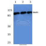 Anti-ERAP1 (K467) Antibody from Bioworld Technology (BS2155) - Antibodies.com
