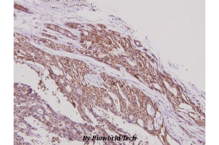Anti-ERAP1 (K467) Antibody from Bioworld Technology (BS2155) - Antibodies.com