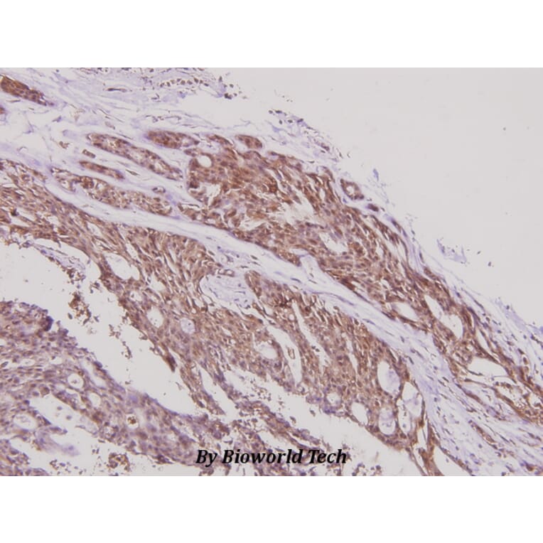 Anti-ERAP1 (K467) Antibody from Bioworld Technology (BS2155) - Antibodies.com