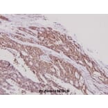 Anti-ERAP1 (K467) Antibody from Bioworld Technology (BS2155) - Antibodies.com