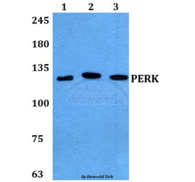 Anti-PERK (R87) Antibody from Bioworld Technology (BS2156) - Antibodies.com