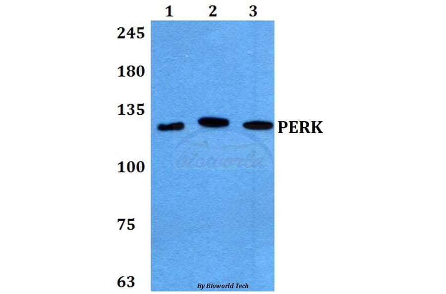 Anti-PERK (R87) Antibody from Bioworld Technology (BS2156) - Antibodies.com