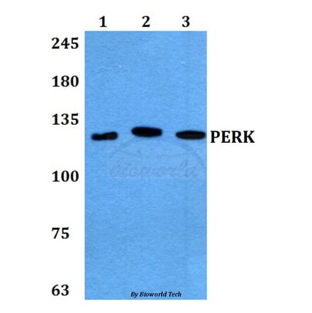 Anti-PERK (R87) Antibody from Bioworld Technology (BS2156) - Antibodies.com
