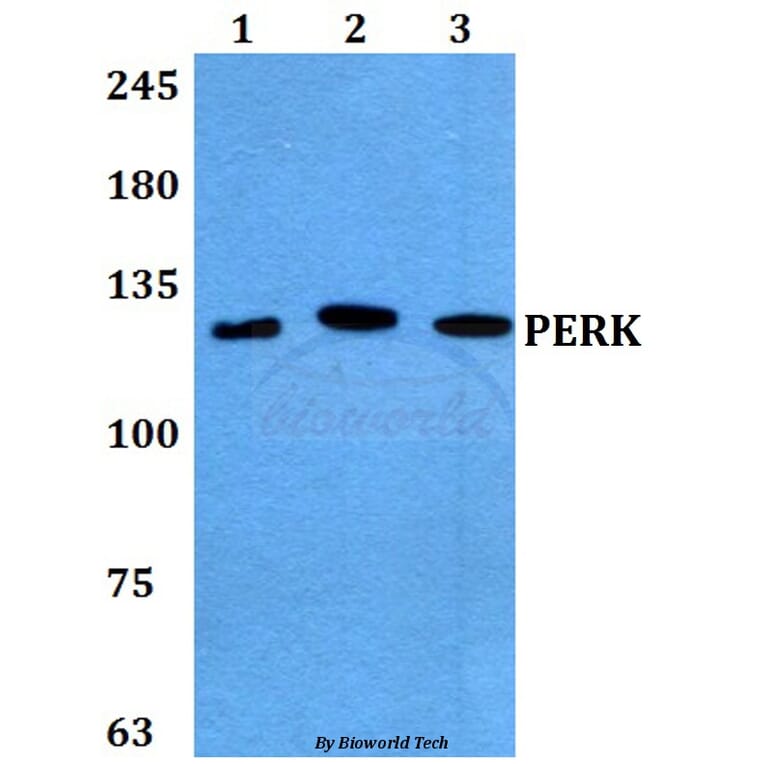 Anti-PERK (R87) Antibody from Bioworld Technology (BS2156) - Antibodies.com