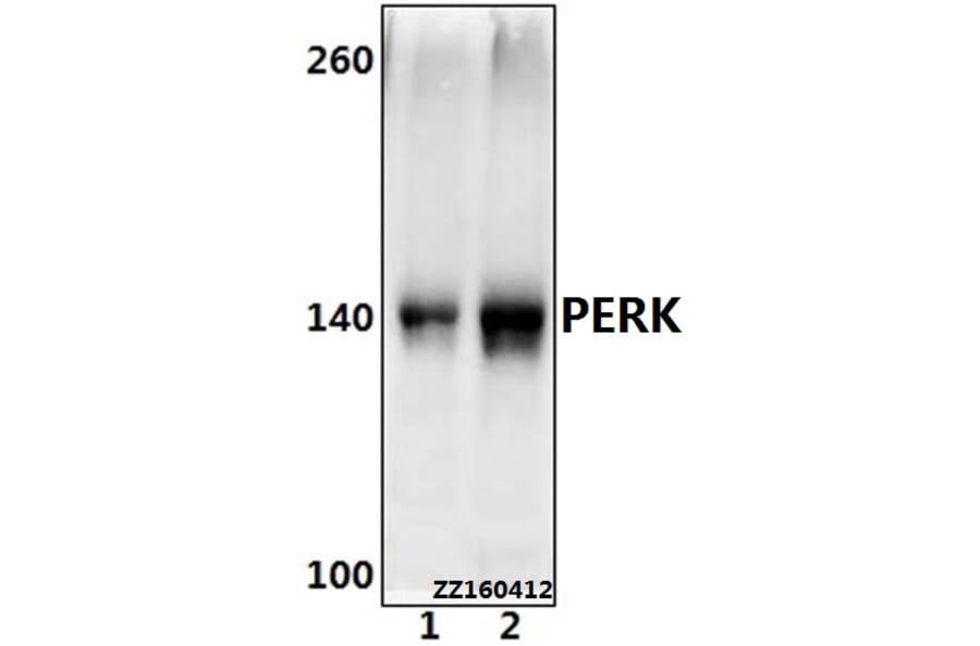 Anti-PERK (R87) Antibody from Bioworld Technology (BS2156) - Antibodies.com