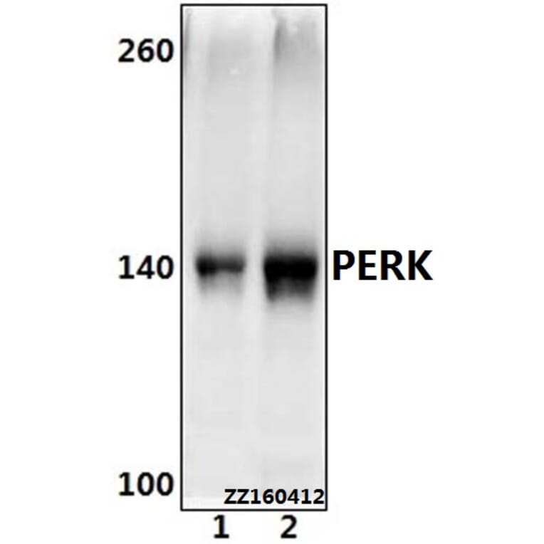 Anti-PERK (R87) Antibody from Bioworld Technology (BS2156) - Antibodies.com