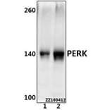 Anti-PERK (R87) Antibody from Bioworld Technology (BS2156) - Antibodies.com