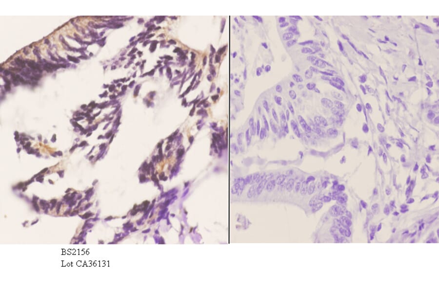 Anti-PERK (R87) Antibody from Bioworld Technology (BS2156) - Antibodies.com