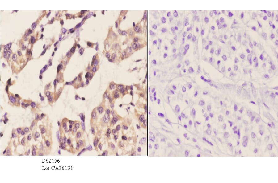 Anti-PERK (R87) Antibody from Bioworld Technology (BS2156) - Antibodies.com