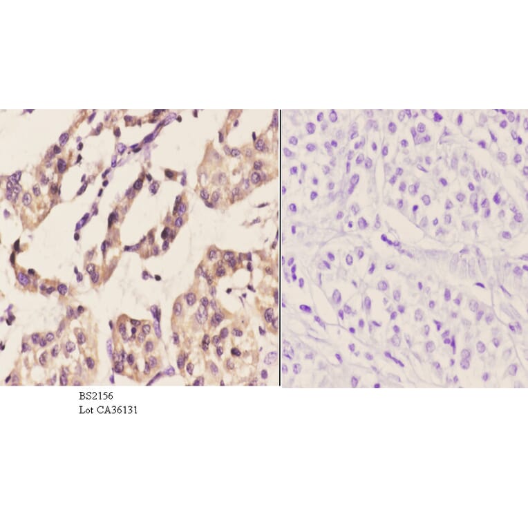 Anti-PERK (R87) Antibody from Bioworld Technology (BS2156) - Antibodies.com