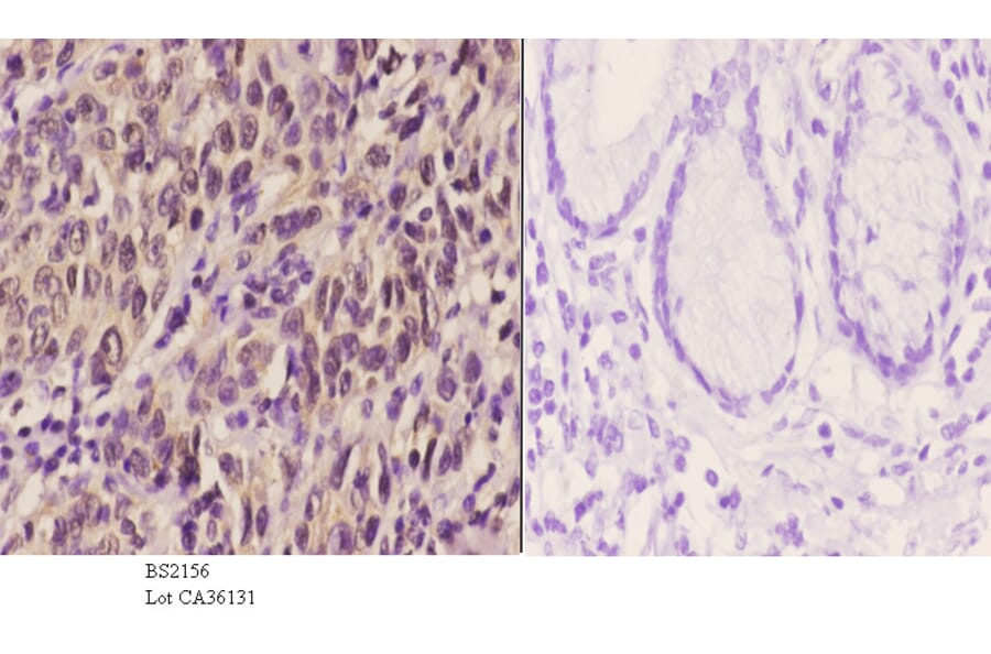 Anti-PERK (R87) Antibody from Bioworld Technology (BS2156) - Antibodies.com