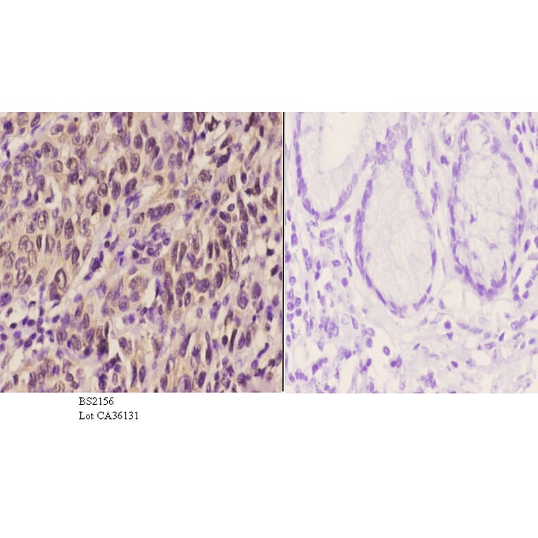 Anti-PERK (R87) Antibody from Bioworld Technology (BS2156) - Antibodies.com