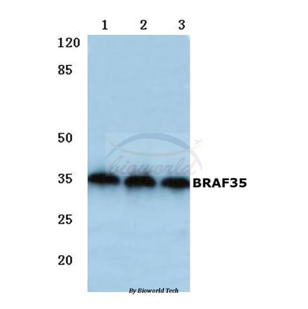 Anti-BRAF35 (T29) Antibody from Bioworld Technology (BS2157) - Antibodies.com