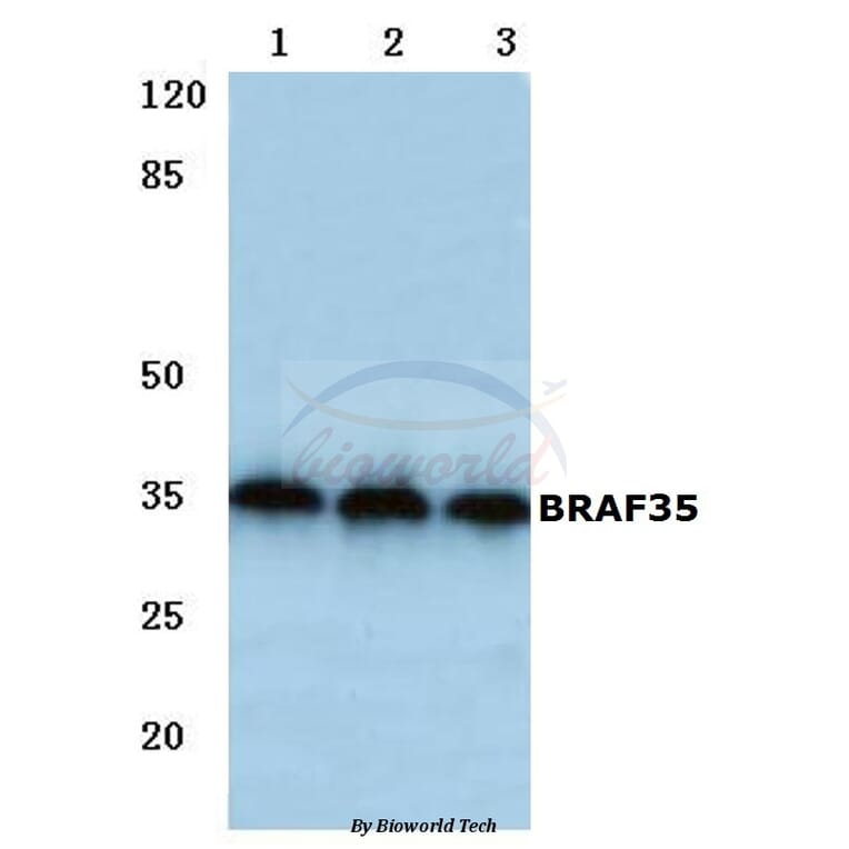 Anti-BRAF35 (T29) Antibody from Bioworld Technology (BS2157) - Antibodies.com